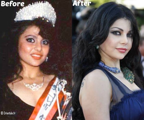 Avant Apres Haifa Wehbe Avant Apres Haifa Wehbe
