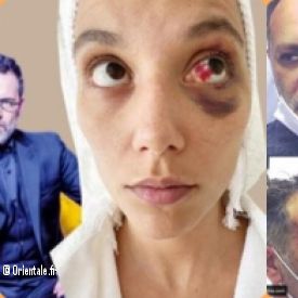 Deniz POLOT-SUZ, Ozan