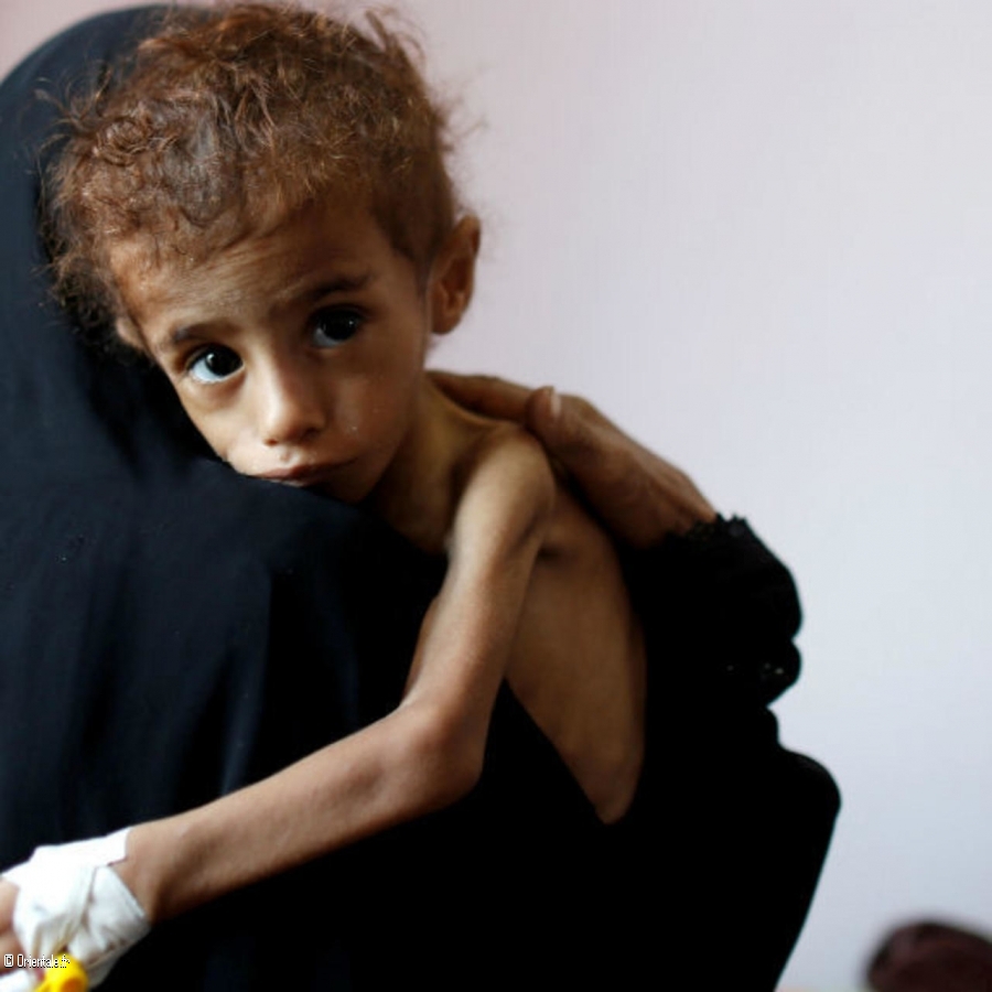 Enfant souffrant de la famine Enfant souffrant de la famine