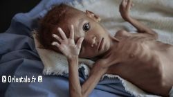 Famine au Yemen