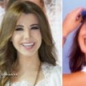 Nancy Ajram a subi plusieurs interventions chirurgicales qu'elle estime suffisantes