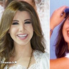 Nancy Ajram a subi plusieurs interventions chirurgicales qu'elle estime suffisantes