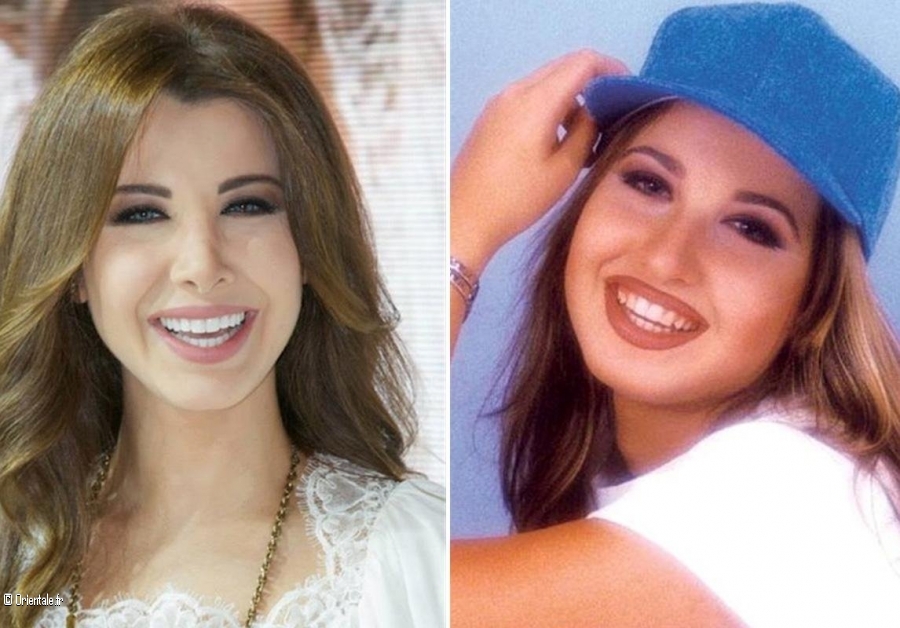 Nancy Ajram a subi plusieurs interventions chirurgicales qu'elle estime suffisantes