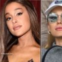 Ariana Grande Avant-Aprs les injections