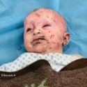 Un bébé palestinien blessé par du phosphore